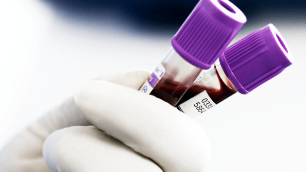 Image of collection tubes for immunoassay testing