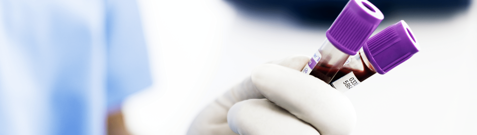 Immunoassay testing cardiac biomarkers Radiometer