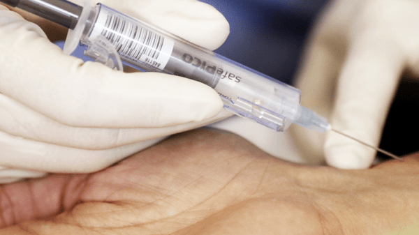 Blood sample taken with SafePICO self fill syringe from Radiometer