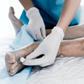 Wound care